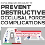 Digital Occlusion Technology to Prevent Destructive Occlusal Force